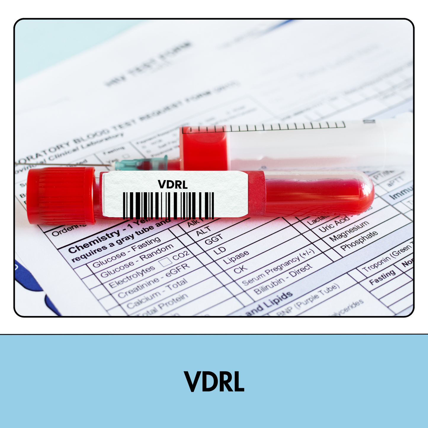 VDRL; RPR (Rapid Plasma Reagin) test in Kolkata