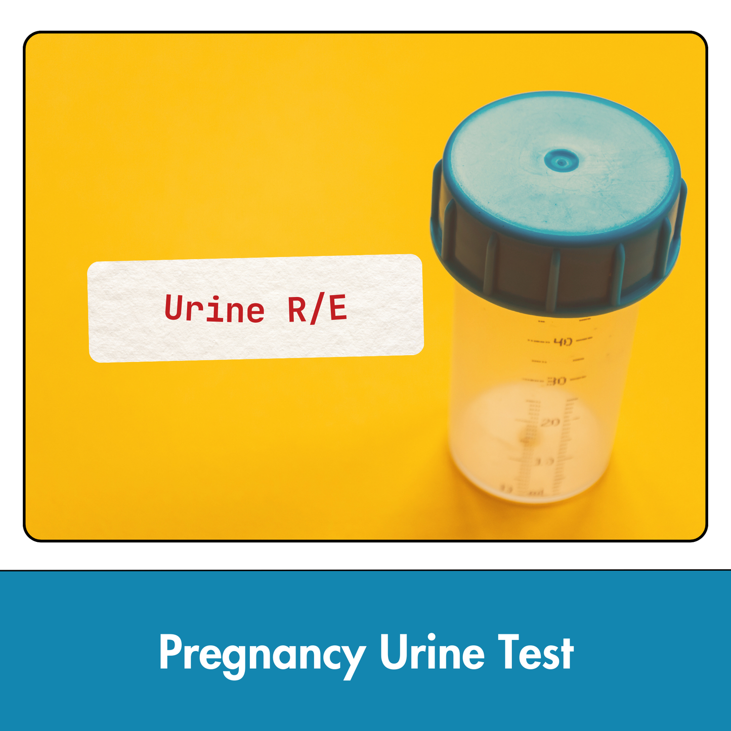 Urine R/M (Urine Routine & Microscopy) test in Kolkata