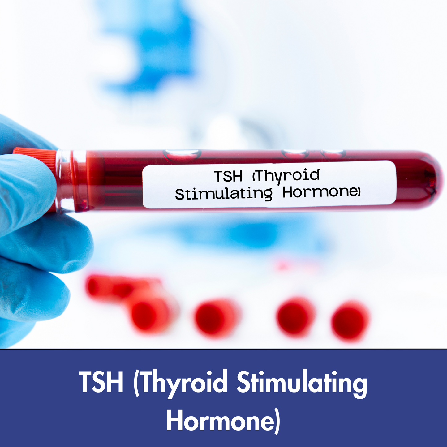 TSH (Thyroid Stimulating Hormone) Ultrasensitive test in Kolkata