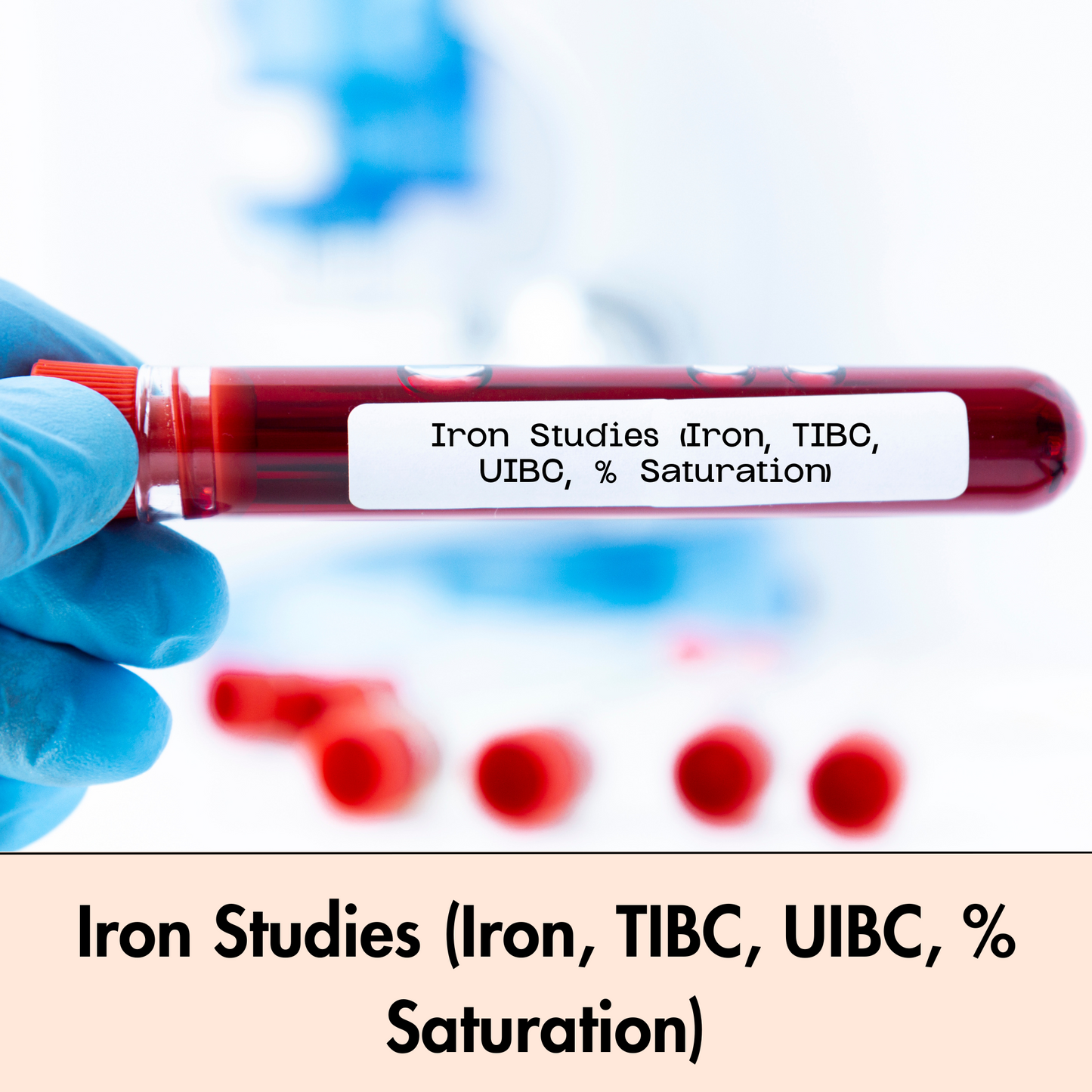 Iron Studies (Iron, TIBC, UIBC, % Saturation) test in Kolkata