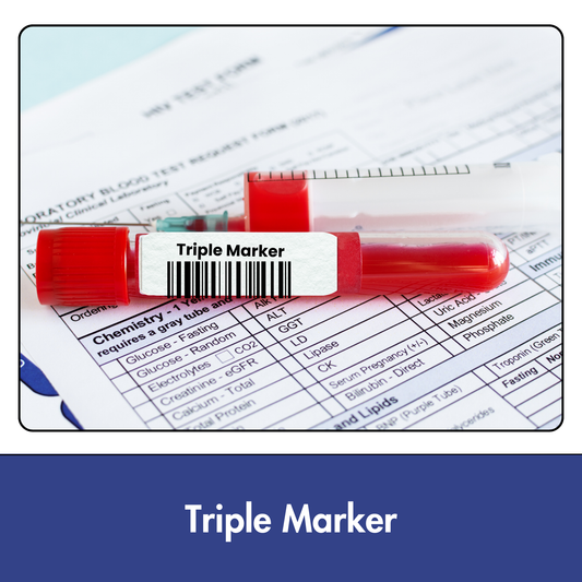 Triple Marker with Graph, 2nd Trimester test in Kolkata