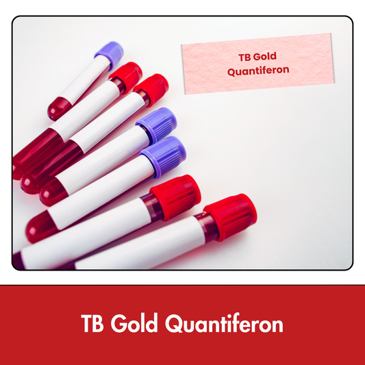 TB Gold Quantiferon test in Kolkata