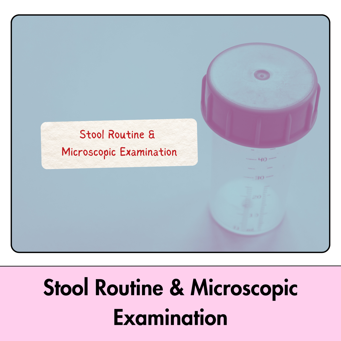 Stool Examination R/M test in Kolkata