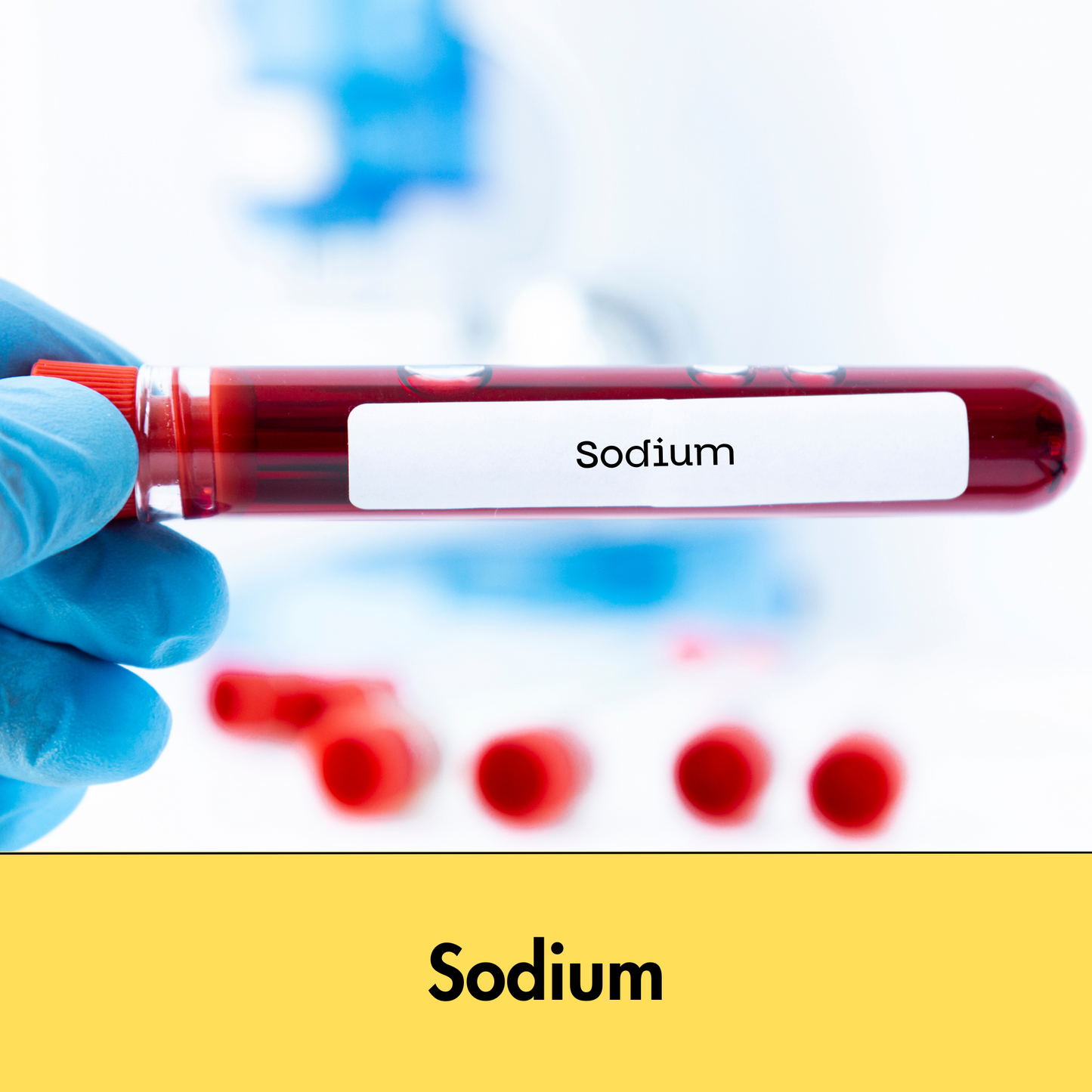 Sodium test in Kolkata