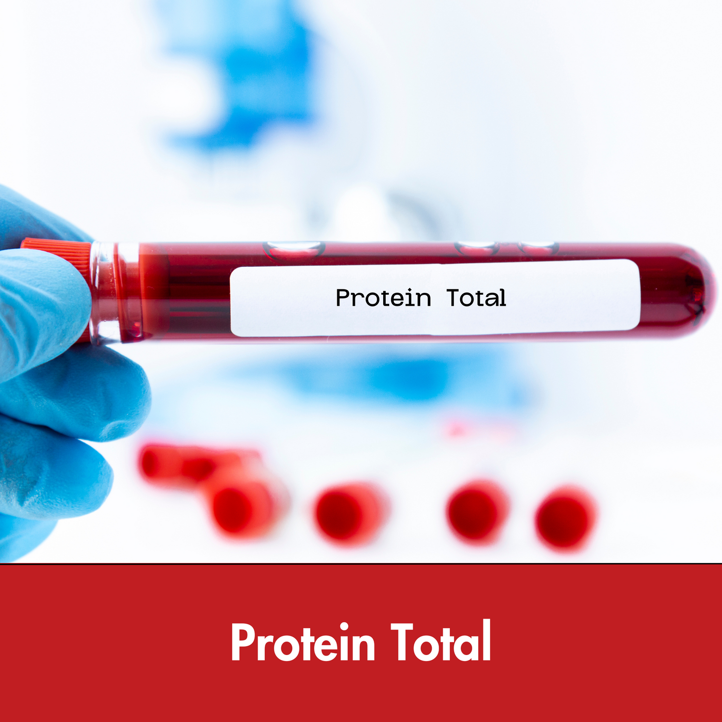 Protein Total, Serum test in Kolkata