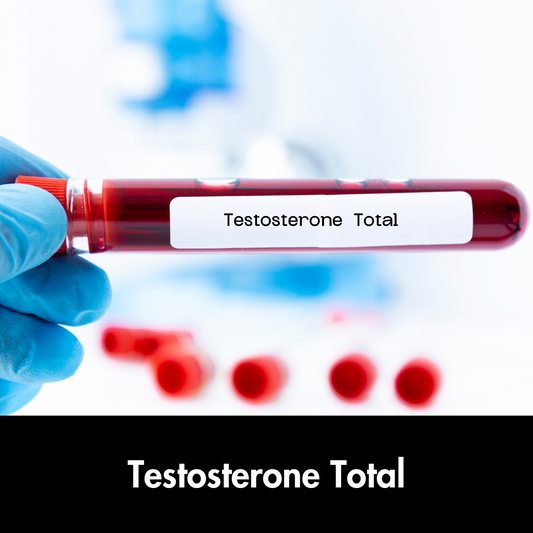 Testosterone Total test in Kolkata