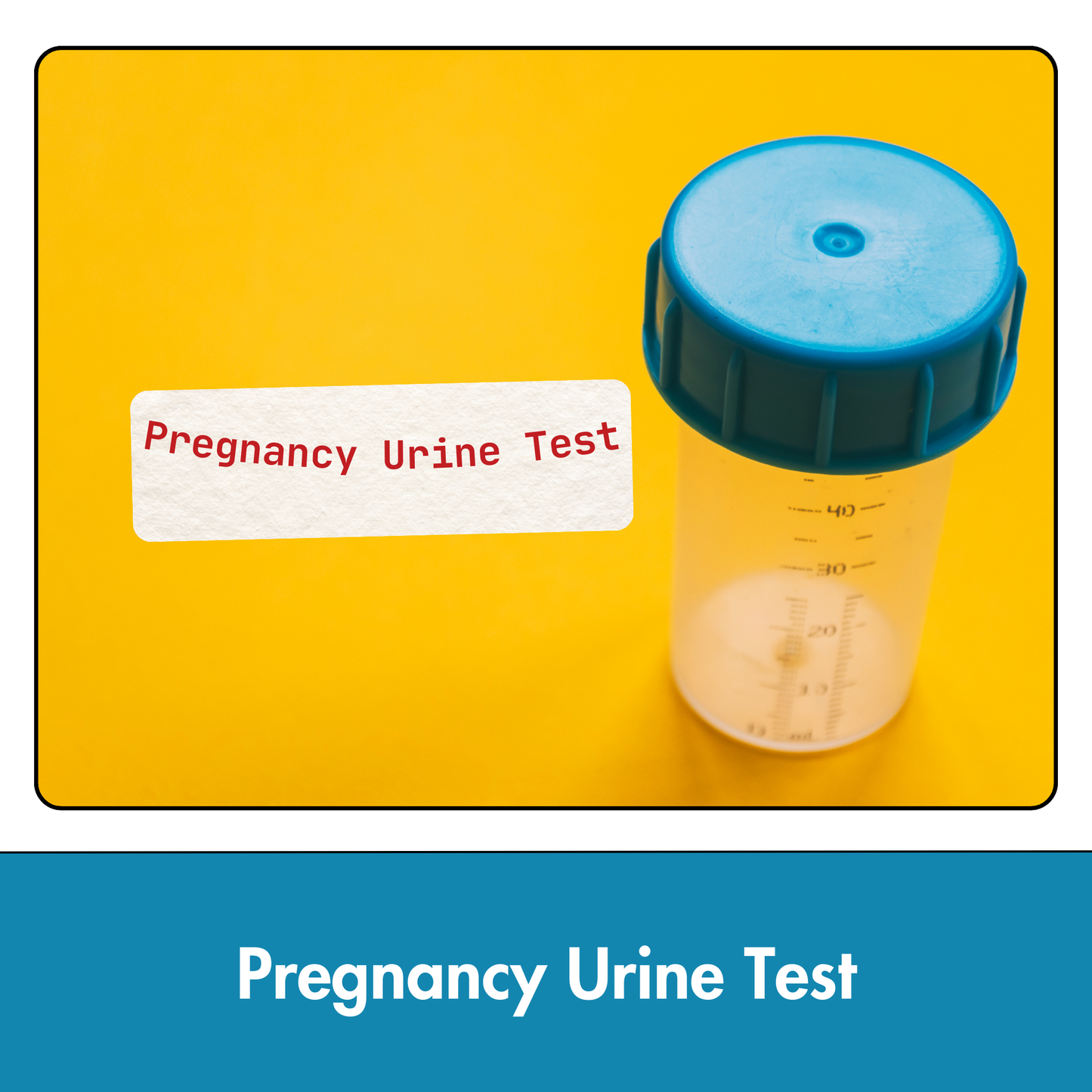 Pregnancy Urine Test in Kolkata