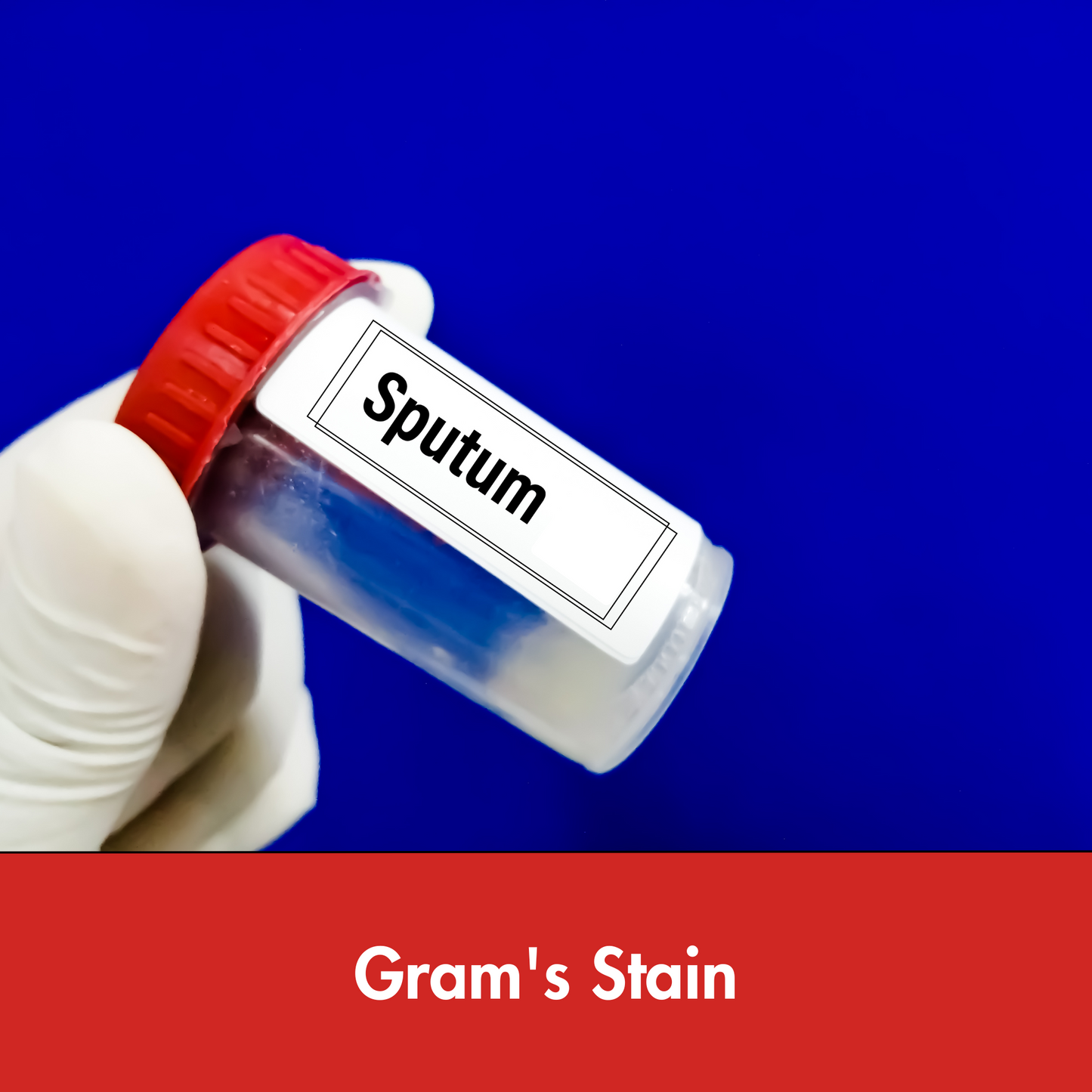 Gram Staining, Sputum test in Kolkata