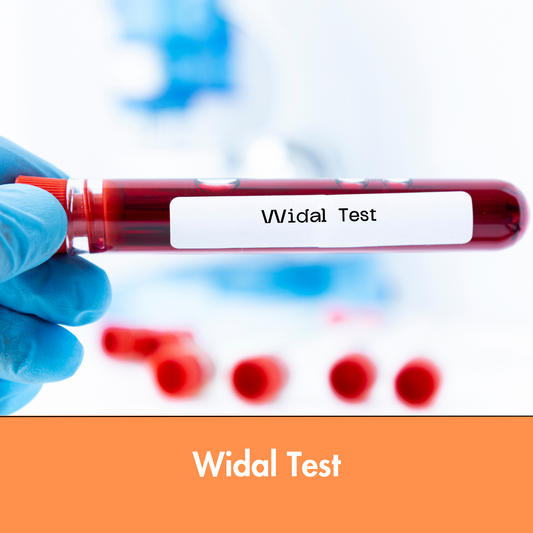 Widal Test (Slide Agglutination) test in Kolkata